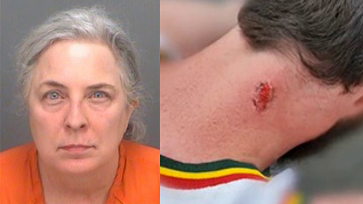 mug shot of woman with grey hair; close up of bite wound on driver's neck